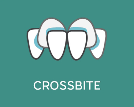 Cross Bite icon