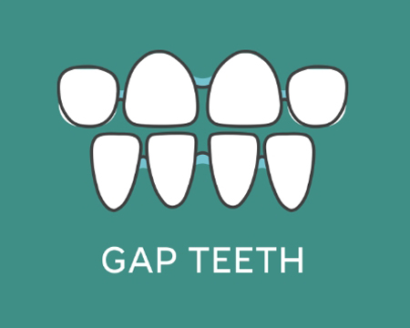Gap Teeth icon