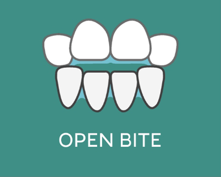 Open Bite icon